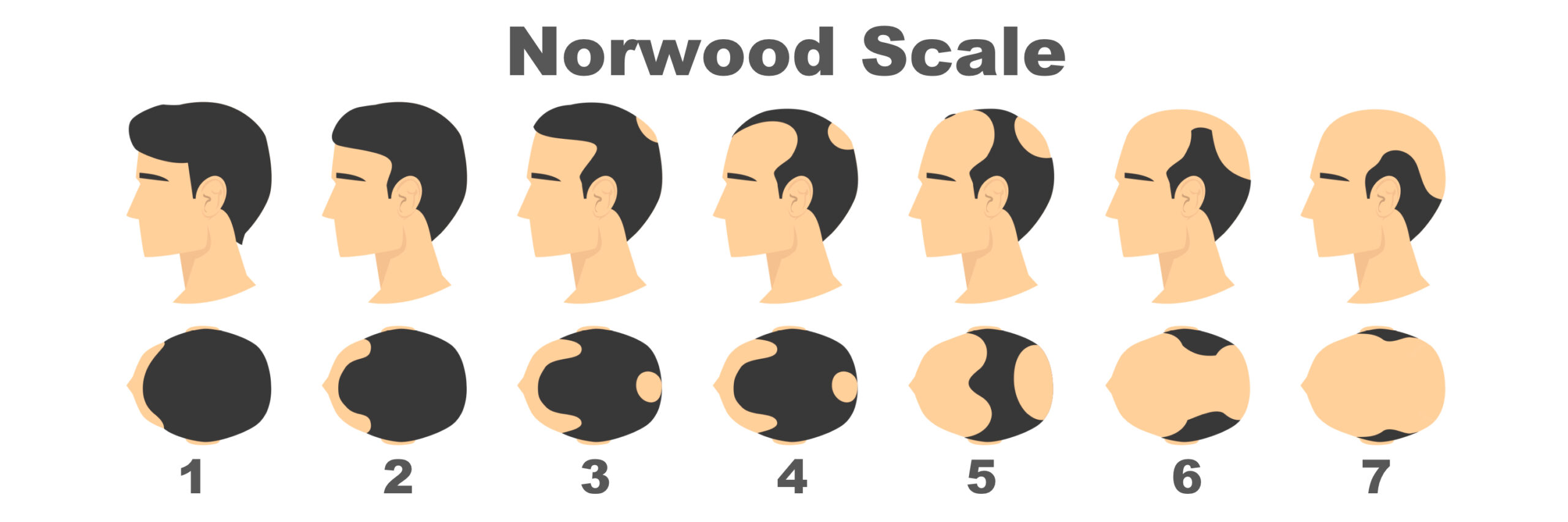 Norwood-scale-7-scaled